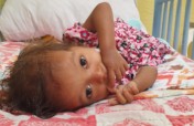 Rescue a Malnourished Child in Guatemala