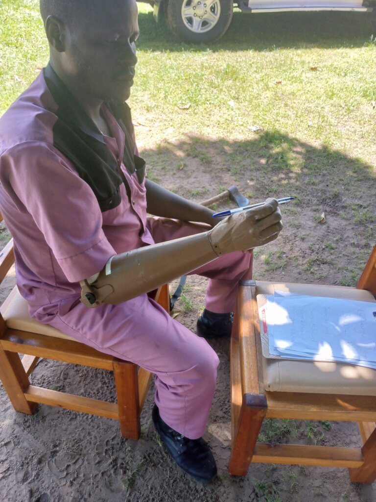 3D Print Upper Limb Prosthetics for 150 in Uganda