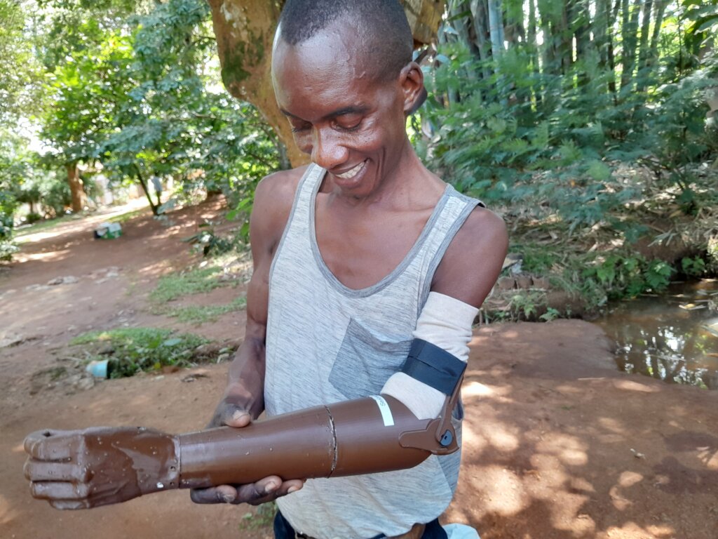 3D Print Upper Limb Prosthetics for 150 in Uganda