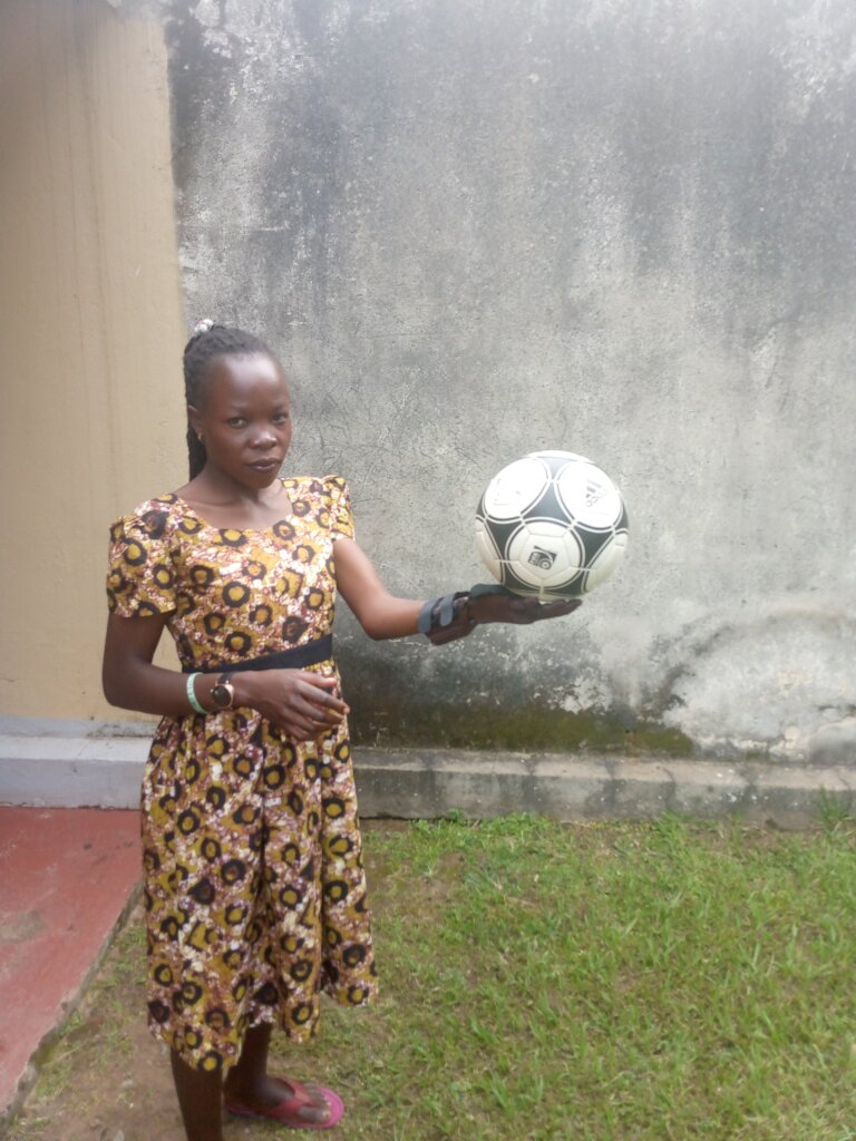 3D Print Upper Limb Prosthetics for 150 in Uganda
