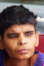 Even $1 Can Help Gift Sight to 8 People Every Day!