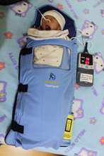 China Program - Baby Long, 930 grams at birth
