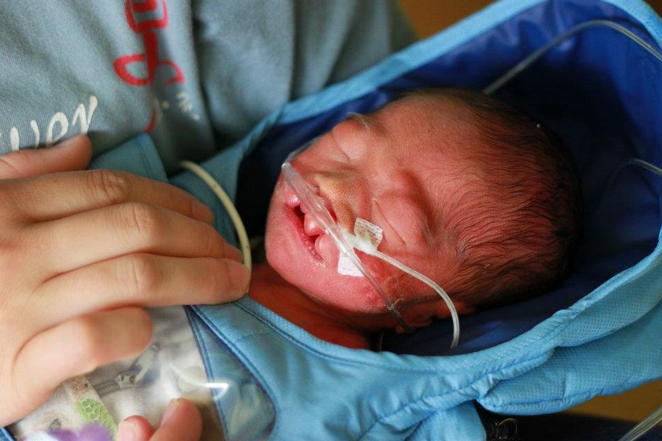 Embrace Infant Warmers Impact Babies Lives India