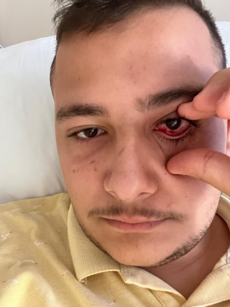 One Eye Left: Help Abdulrahman Keep His Sight