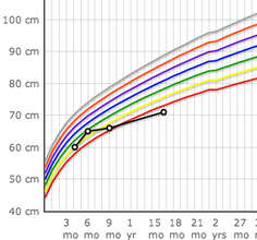 Example of a growth curve for a malnourished child