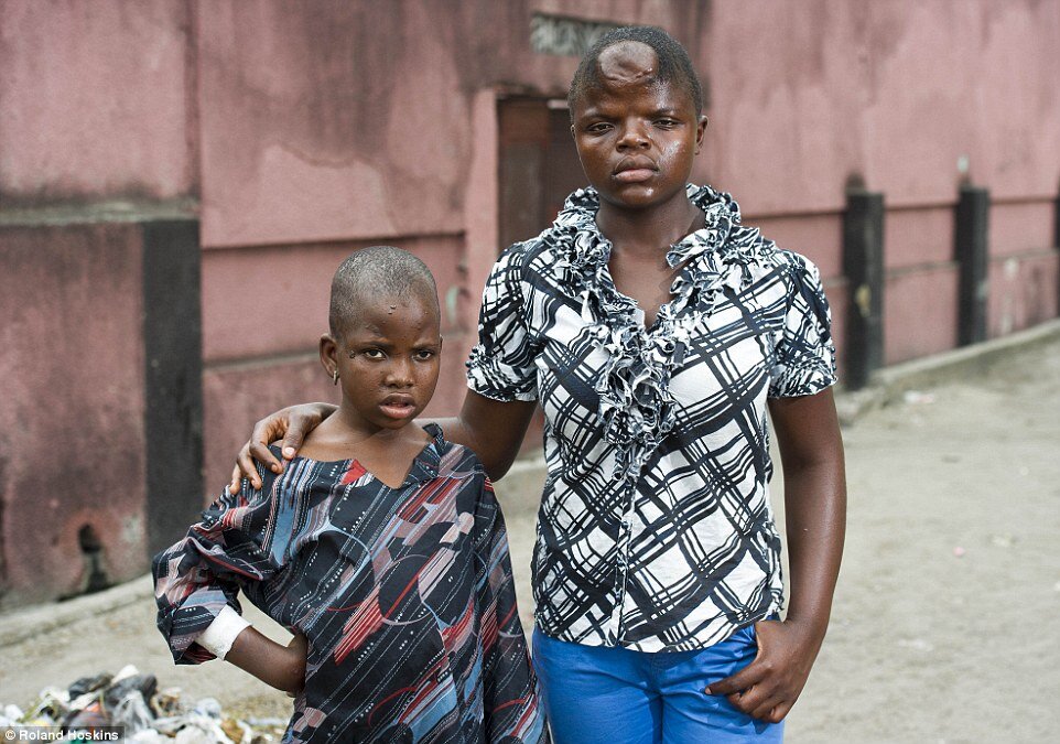 Save Children Accused of Witchcraft in Africa