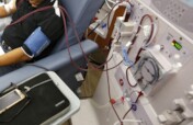 Free Dialysis for 500 Kidney Patients in Nigeria
