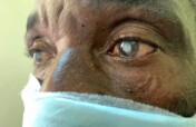 Restore Sight to 500 Nigerians with Cataracts.
