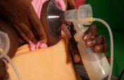 Breast Milk Bank for Mothers Who Lost Both Breast