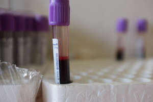 Blood sample