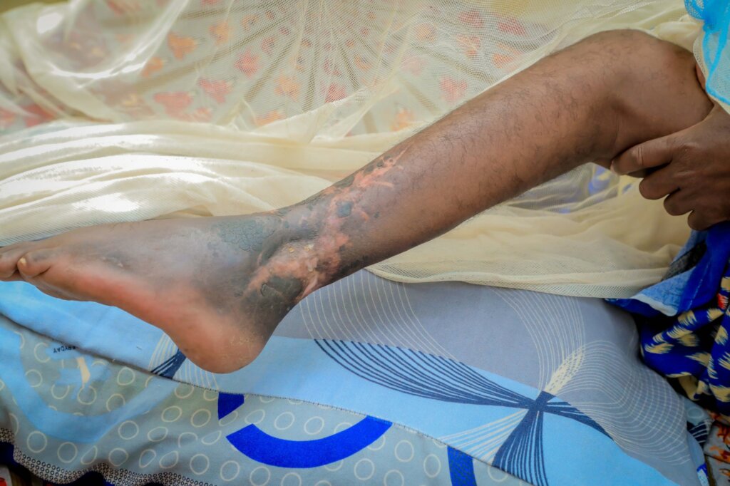 COMPREHENSIVE CARE AND REHABILITATION CENTER