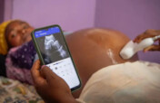 Phone-Based Ultrasounds for 500 Rural Hospitals