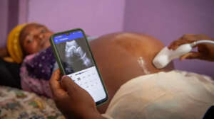 Phone-Based Ultrasounds for 500 Rural Hospitals