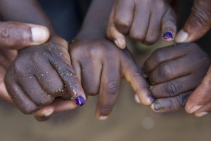 Purple nails to identify who has been vaccinated