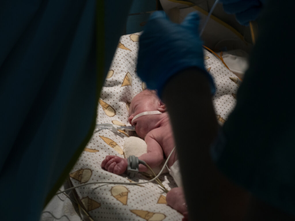 Help Premature Babies Take Their First Breath