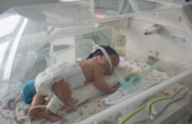 Help Premature Babies Take Their First Breath