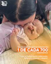 1 de cada 700 bebes nace con esta condicion