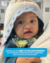 Cada nino merece una oportunidad para sonreir