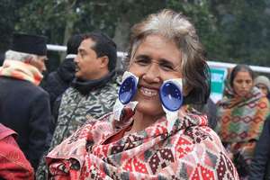 Nepalese patient.