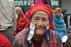 A patient after a successful cataract surgery.