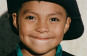 Operation Smile: Improve Surgical Access Globally