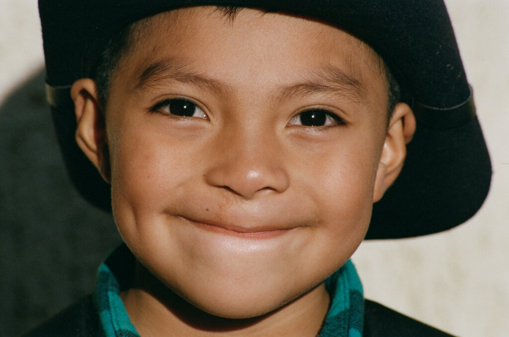 Operation Smile: Improve Surgical Access Globally