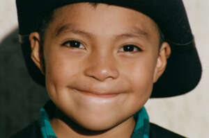 Operation Smile: Improve Surgical Access Globally