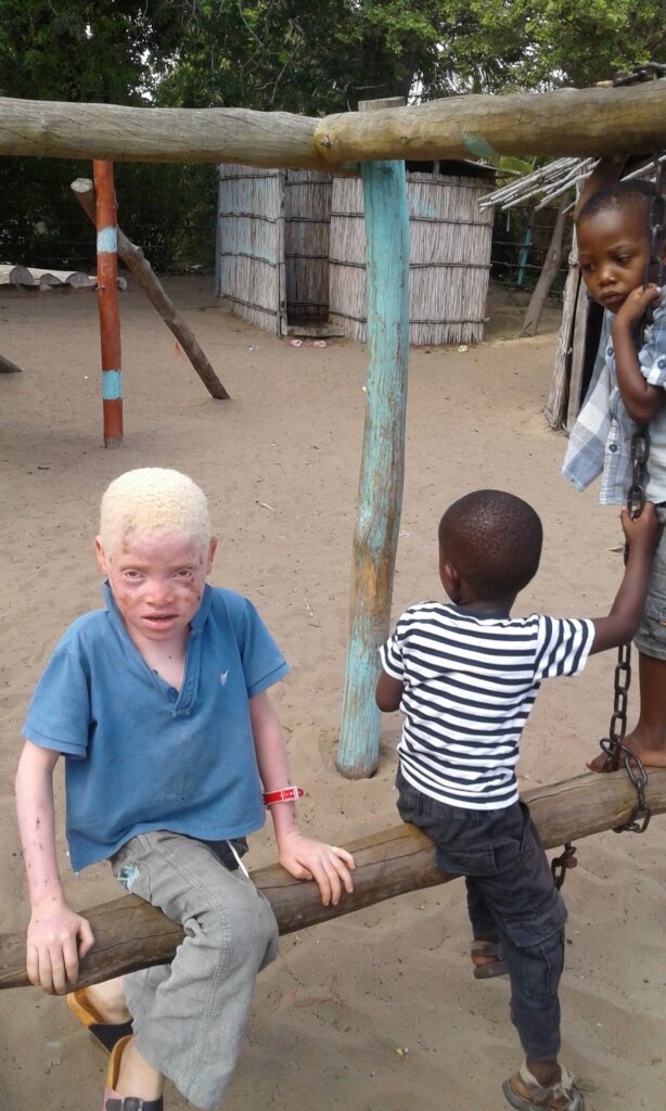 Luz - Sunscreen for Children with Albinism