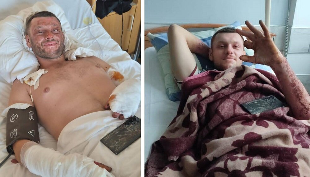 Slovenian Hero Artur: Rehab for Bilateral Amputee