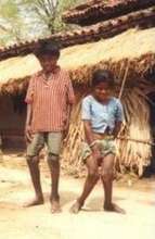 Children with Fluorosis