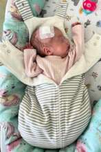 Newborn after life-saving surgery