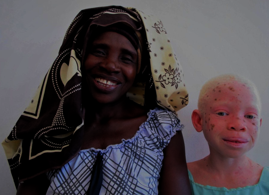 Protecting Women & Children with Albinism
