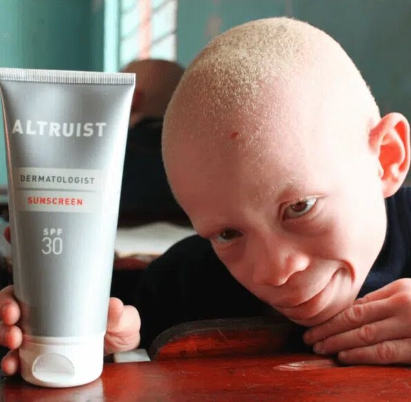 Protecting Women & Children with Albinism