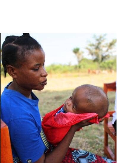Heal 300 Kids with Hydrocephalus & BF in Tanzania