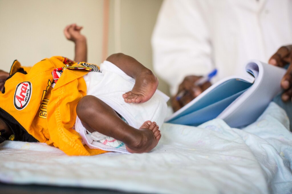 Treating clubfoot for 100 children in Nigeria