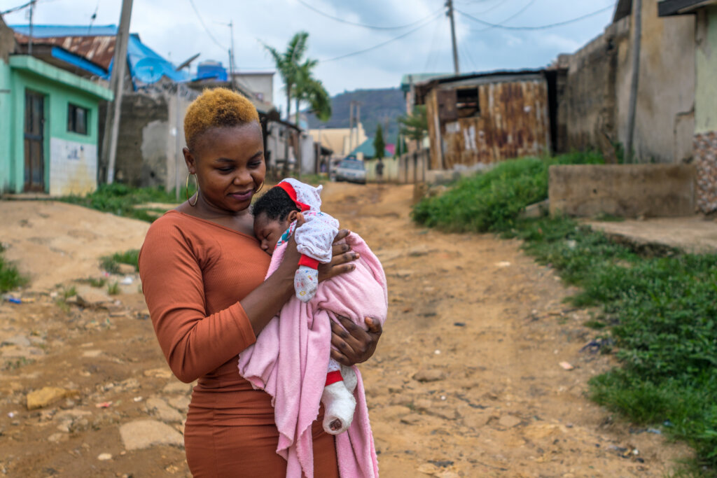 Treating clubfoot for 100 children in Nigeria