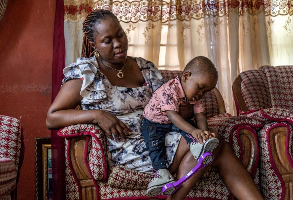 Treating clubfoot for 100 children in Nigeria