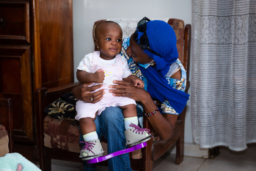 Treating clubfoot for 100 children in Nigeria