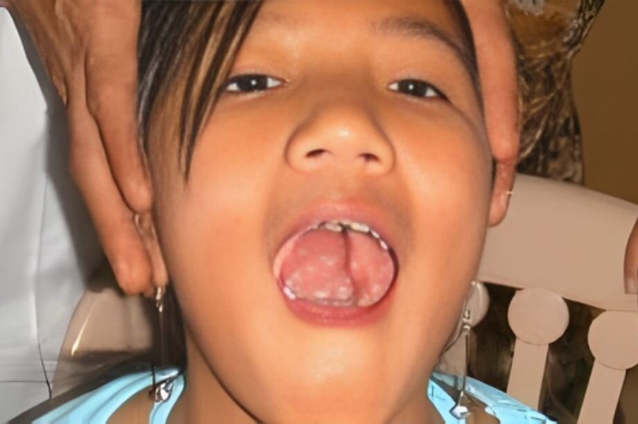 Transforming Lives: Cleft Surgery in Pakistan