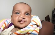 Transforming Lives: Cleft Surgery in Pakistan