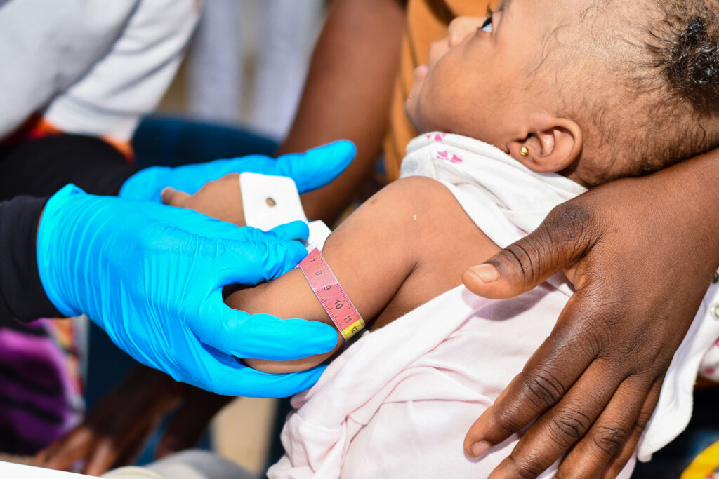 Malnutrition Alleviation Program