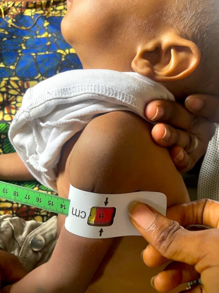 Fund Emergency Care for 1,000 Children and Mothers