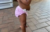 Give Baby 'B' the Gift of Walking Freely