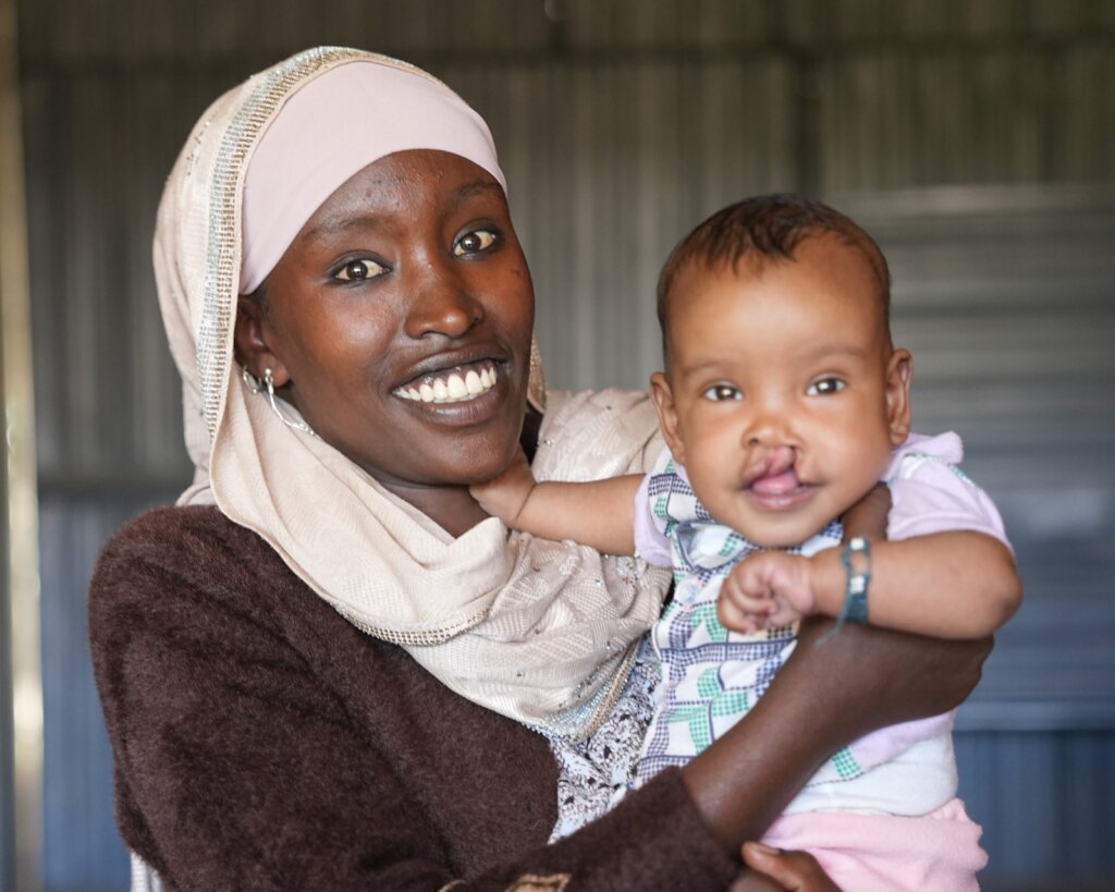 Saving Lives of Newborns with Cleft in Ethiopia