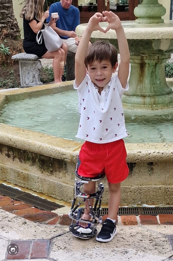 Let's help Kevin walk