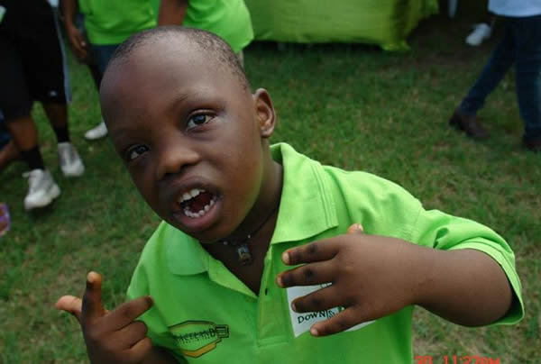 Support Children with Down Syndrome in Nigeria
