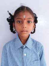 Save Baby Bhavani: Urgent Brain Surgery & ICU Care