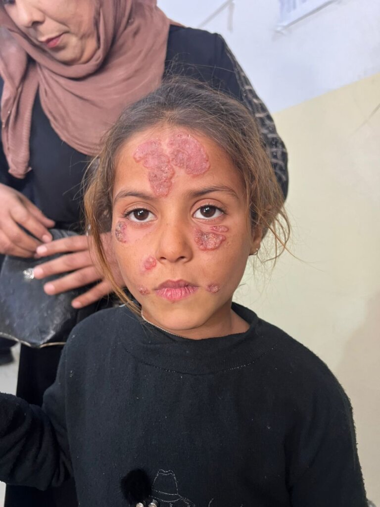 Leishmaniasis Control Project in Al-Raqqa, Syria