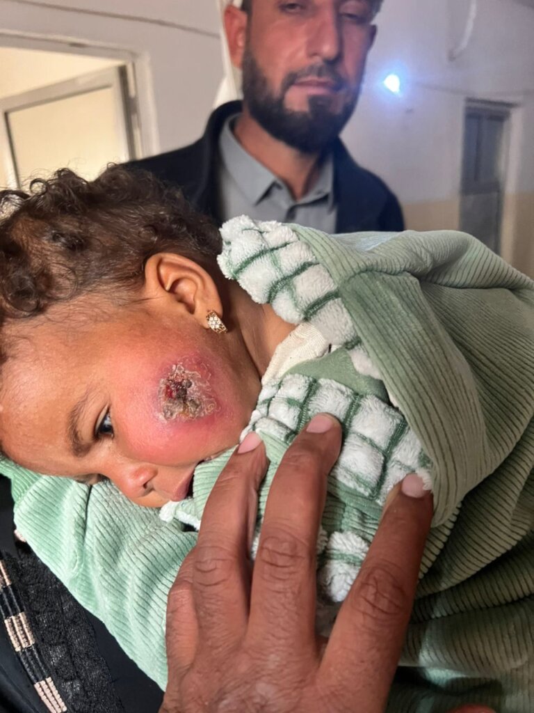 Leishmaniasis Control Project in Al-Raqqa, Syria