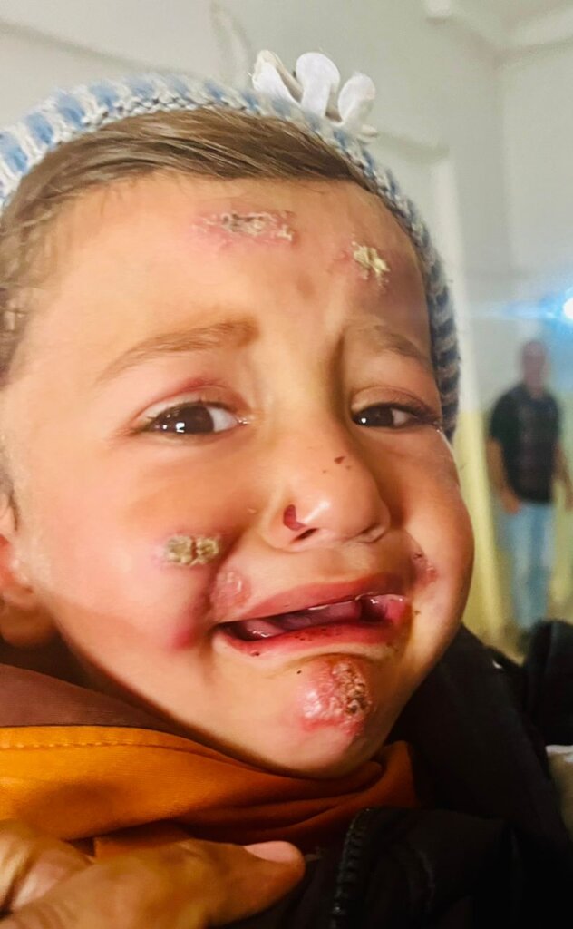 Leishmaniasis Control Project in Al-Raqqa, Syria